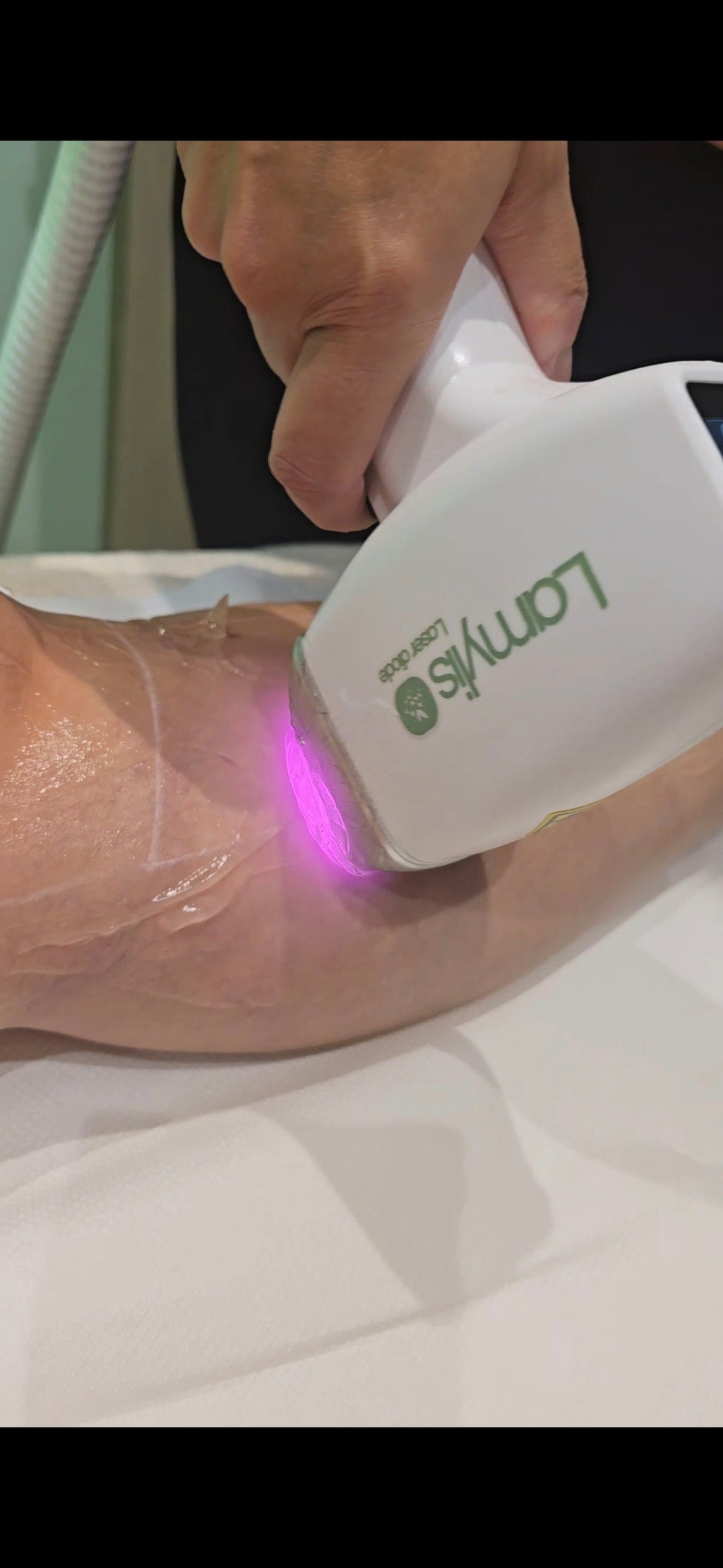 6 séances de laser sur les aisselles - L'instant Nature Ustaritz